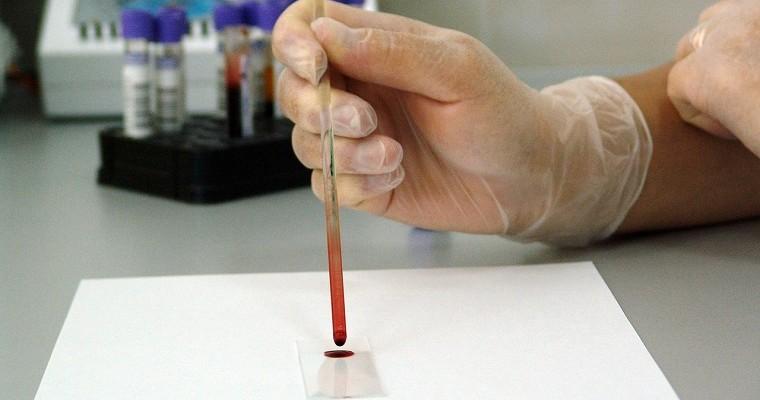 Badanie próbki krwi w laboratorium