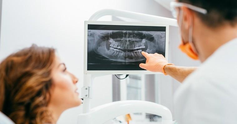 Hiperdoncja, czyli zwiększenie liczby zębów 