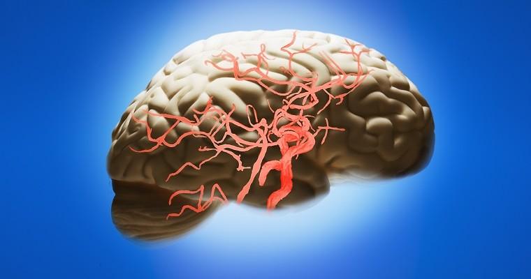 Mózg - naczynia krwionośne w mózgu
