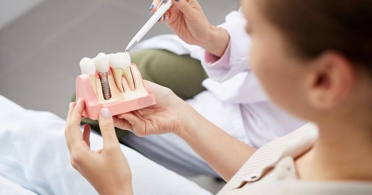 Kobieta u dentysty, któr ogląda implant zębowy 