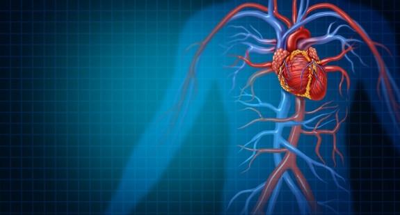 Rozwarstwienie aorty – objawy, przyczyny, diagnostyka, jak leczyć?
