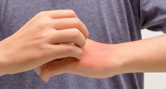 Swędzenie dłoni po zewnętrznej i wewnętrznej stronie – przyczyny i możliwe choroby