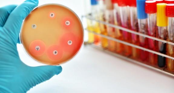 Antybiogram – zrób badanie zanim weźmiesz antybiotyk!