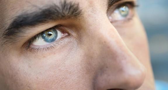 Podkrążone oczy – jak z nimi walczyć? Przyczyny podkrążonych oczu