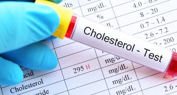 Czy niski poziom cholesterolu jest niebezpieczny? Sprawdź!