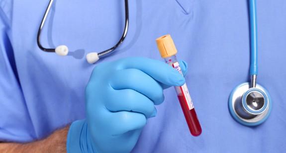 Jakie są pierwsze objawy anemii? 