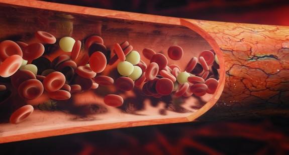 Bazofile we krwi – przyczyny niskiego i wysokiego poziomu, o czym świadczą wyniki poza normą