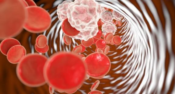 Leukocytoza – o czym może świadczyć nadmiar białych krwinek w organizmie?