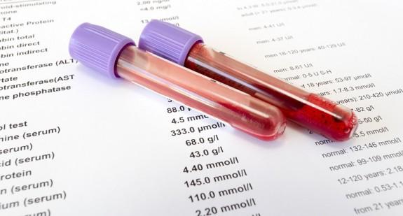 Biochemia krwi (badanie biochemiczne) – jak interpretować wyniki? 