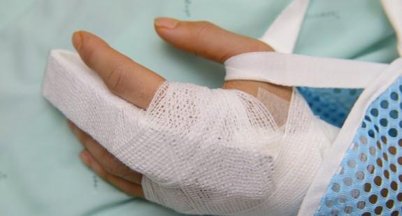 Ucięty palec lub opuszek – pierwsza pomoc, utrata zdrowia, odszkodowanie