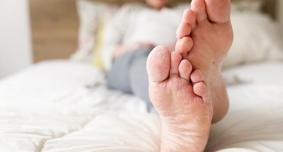 Pieczenie stóp od spodu – jakie mogą być przyczyny tej dolegliwości?