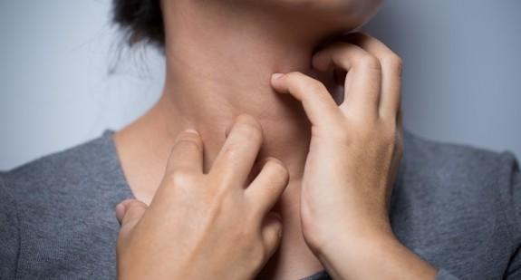 Co może powodować swędzenie szyi? Chora tarczyca, reakcja alergiczna, tło nerwowe…