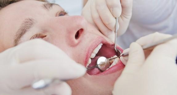 Resekcja zęba – przebieg, wskazania, przeciwwskazania i powikłania