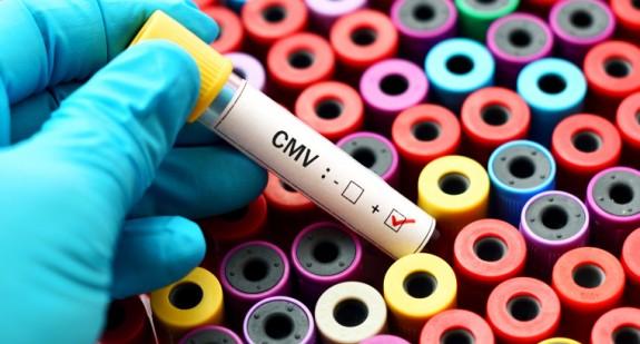 Cytomegalia (cytomegalowirus) – co to jest? Przyczyny, objawy, leczenie