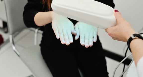 Jak objawia się łuszczyca dłoni? Przyczyny przewlekłej choroby skóry i jej leczenie 