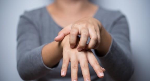 Czym jest kontaktowe zapalenie skóry? Leczenie domowe i specjalistyczne