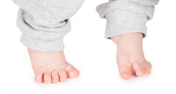 Chodzenie na palcach u dziecka jako normalne zjawisko i jako objaw choroby
