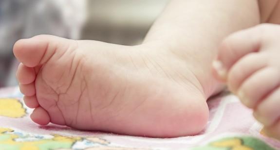 Płaskostopie u dzieci – rozpoznanie, dobór obuwia, leczenie