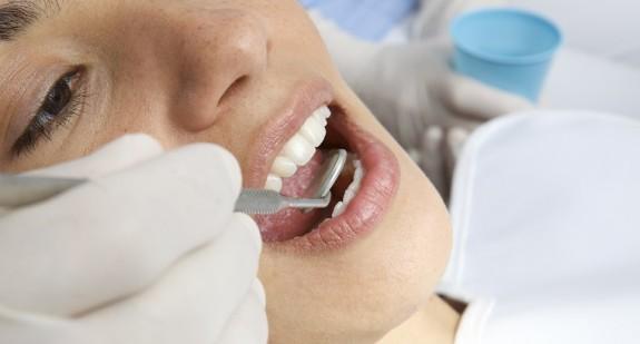 Czym jest trepanacja zęba? Wskazania, przeciwwskazania, koszt i przebieg zabiegu
