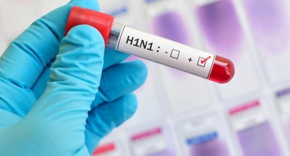 Świńska grypa – objawy, leczenie i profilaktyka