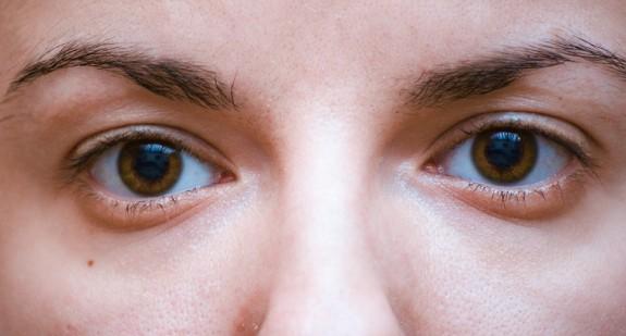 Podkrążone oczy i ich najczęstsze przyczyny. Najlepsze sposoby na wory pod oczami