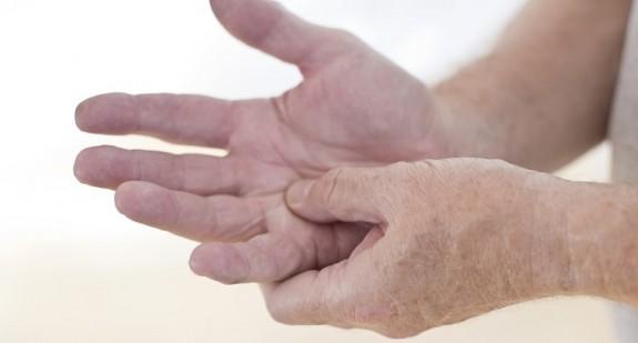 Pękająca skóra na dłoniach. Jak zapobiegać i jak pielęgnować?