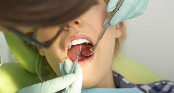 Odsłonięte szyjki zębowe – objawy, przyczyny i leczenie