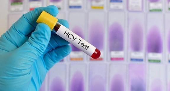 Badanie HCV w ciąży – przebieg i cena. Jakie ryzyko dla dziecka niesie zakażenie HCV u matki?