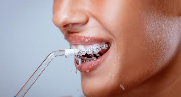  Irygator do zębów – niezastąpiona specjalistyczna pomoc w higienie jamy ustnej