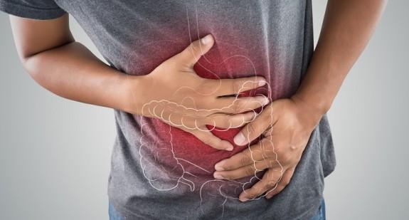 Desmosis coli – jak przebiega jedna z najrzadszych chorób i jak ją leczyć?