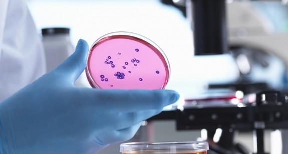 Czy w zaawansowanej paradontozie warto robić test na bakterie i ich rodzaj aby przepisać odpowiedni antybiotyk? 