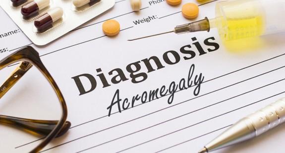 Akromegalia - to nie odmienny wygląd czyni tę chorobę groźną