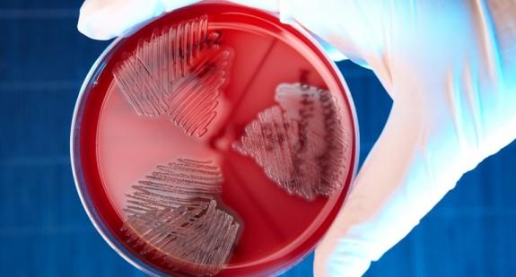 Streptococcus agalactiae - co to jest? Jakie daje objawy i jak leczyć? 
