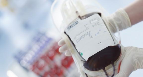 Przetaczanie (transfuzja) krwi – zasady, wskazania, możliwe powikłania