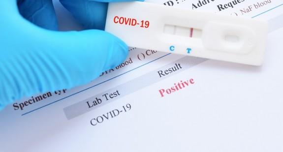 Koronawirus. Czy szybkie testy na COVID-19 są wiarygodne? 