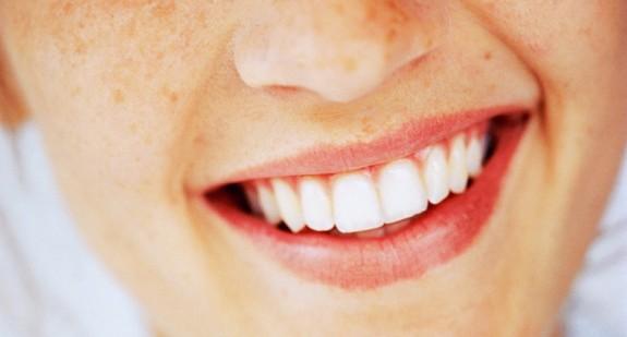 Zgryz przewieszony – nieprawidłowe ułożenie zębów w jamie ustnej. Jak się leczy tę wadę?
