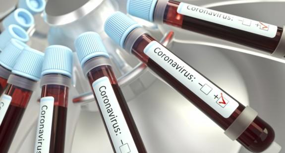 Koronawirus. Trzy rodzaje testów w diagnostyce COVID-19 
