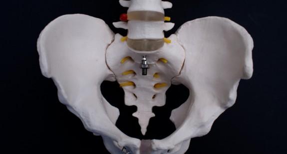 Kość ogonowa: powody bólu kości guzicznej i sposoby jego leczenia