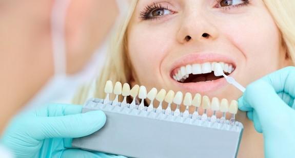Wybielanie zębów węglem, czyli domowe metody na piękny uśmiech
