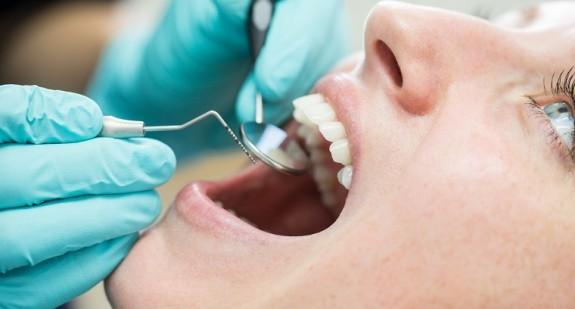 Na czym polega demineralizacja zębów? Jak leczyć tę dolegliwość?
