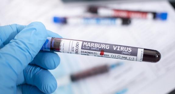 Wirus Marburg. Czy grozi nam kolejna pandemia? 