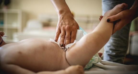 Odparzenia u niemowląt, dzieci i dorosłych – leczenie i profilaktyka