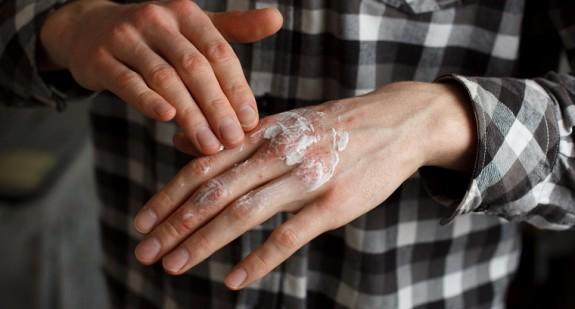 Grzybica skóry gładkiej – rodzaje, objawy, przyczyny i leczenie
