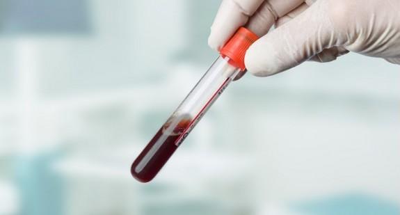 Test z krwi wykryje raka na długo przed pojawieniem się objawów