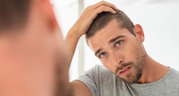 Co trzeci mężczyzna po 25. roku życia łysieje! Winne są nie tylko geny 