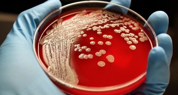 Naukowcy opracowali antybiotyk, który radzi sobie z opornością bakterii 