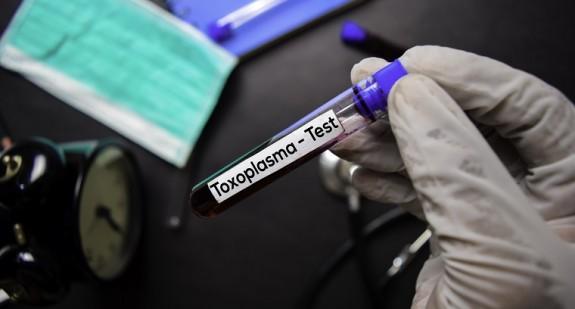 Polacy opracowali metodę, która pozwala na wczesne wykrycie toksoplazmozy 