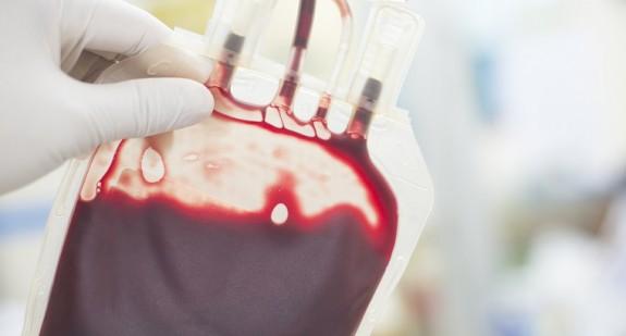 Jakie są przeciwwskazania do oddania krwi? Co ile można oddać krew?